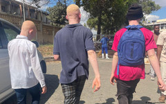 Животът на албиносите - ежедневие, митове и решения