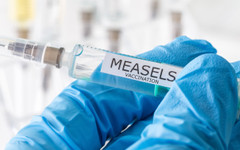 Потвърдените случаи на морбили у нас са вече 137