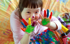 Медици заглушиха гена, предизвикващ Синдрома на Даун