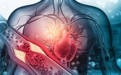 Само хората с наднормено тегло ли са изложени на риск от висок холестерол