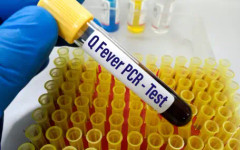 Първи случай на ку-треска в Пловдив