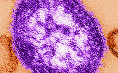 Първи случаи на морбили във Варна