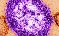 Първи случаи на морбили във Варна